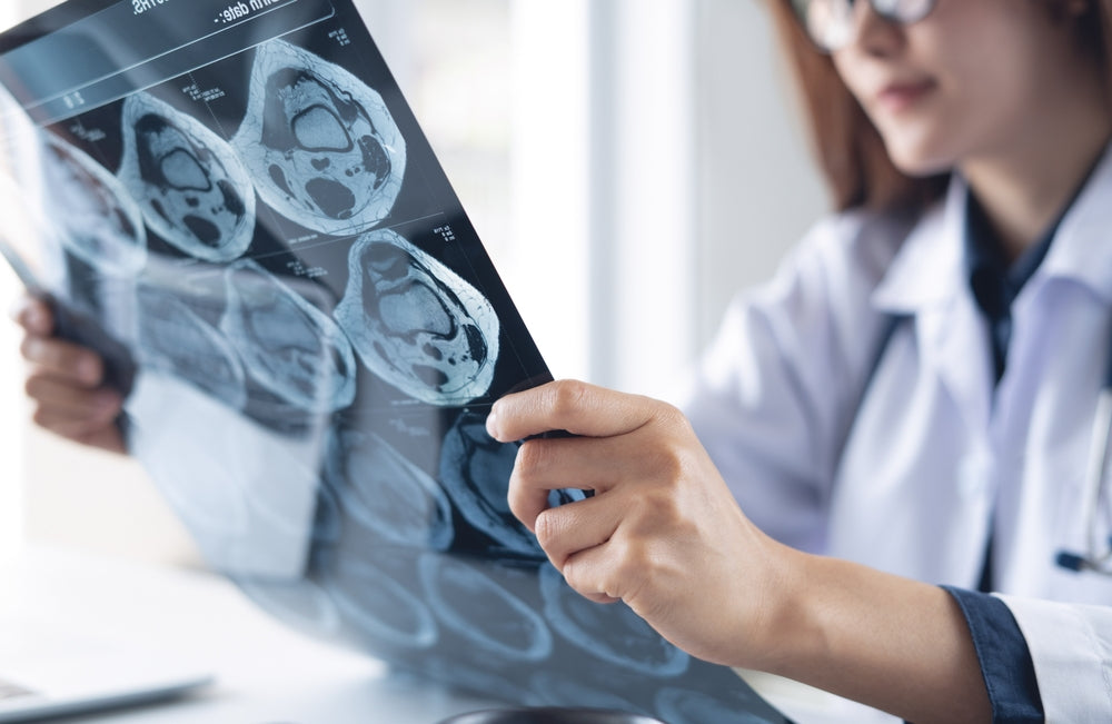 Simplify MRI Supply Replenishment